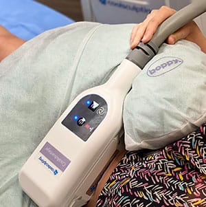 CoolSculpting device