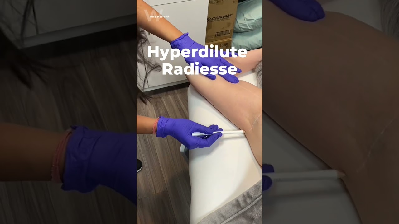Radiesse video thumbnail