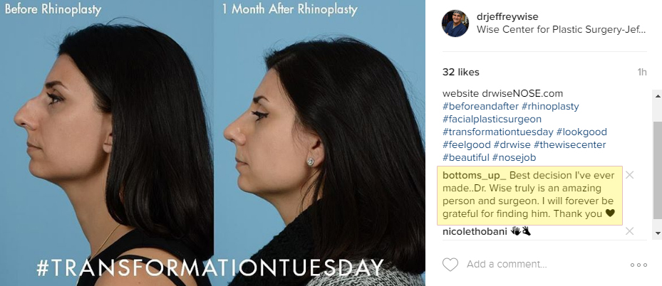 B&A Instagram post