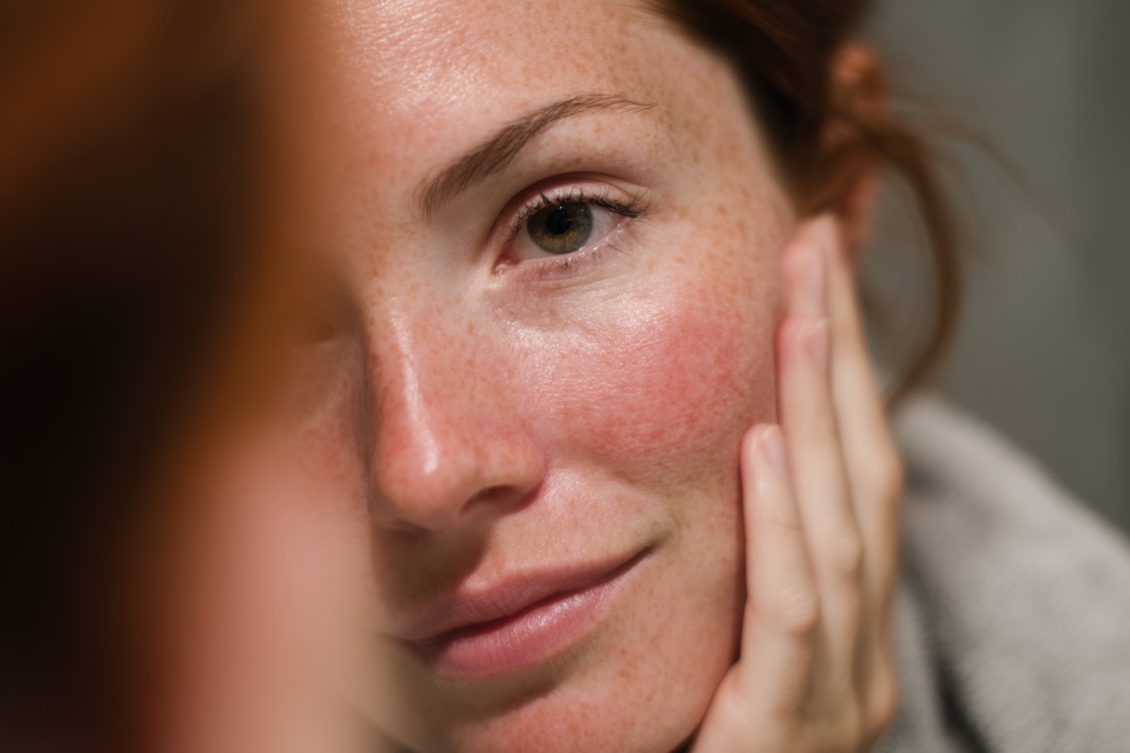 Woman getting face treatment