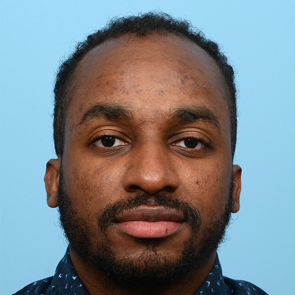 Fue Before and After | Dr. Jeffrey Wise
