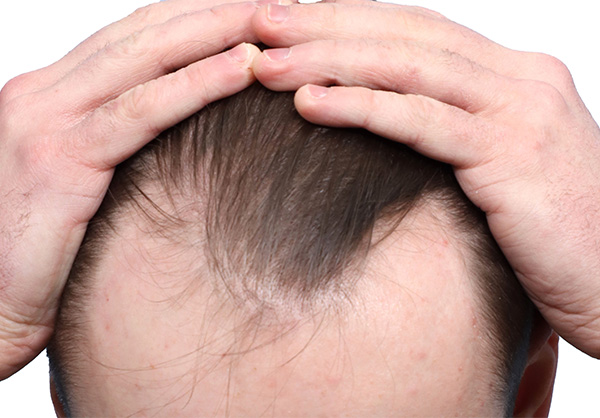 Fue Before and After | Dr. Jeffrey Wise