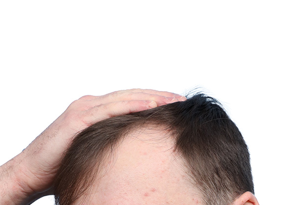 Fue Before and After | Dr. Jeffrey Wise