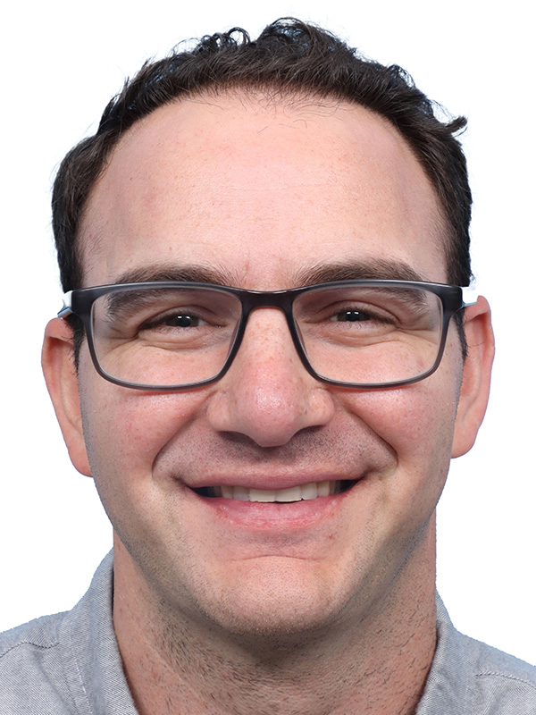 Fue Before and After | Dr. Jeffrey Wise