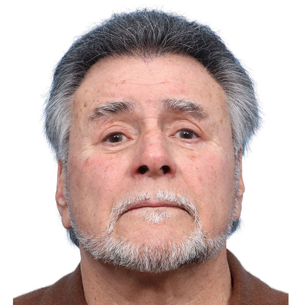 Fue Before and After | Dr. Jeffrey Wise