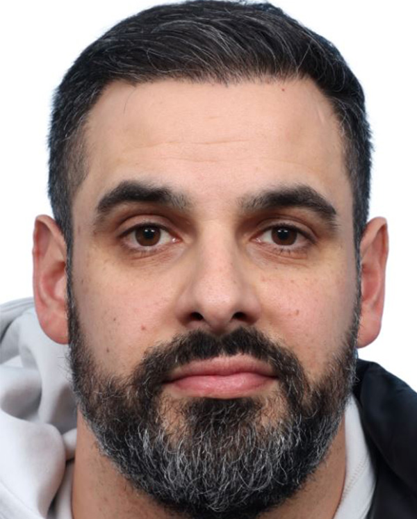 Fue Before and After | Dr. Jeffrey Wise